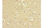 Immunohistochemistry of paraffin-embedded human brain tissue CSB-PA007865LA01HU at dilution 1:100