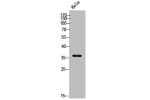 Western Blot analysis of HeLa cells using E2F-5 Polyclonal Antibody