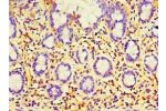 Immunohistochemistry of paraffin-embedded human small intestine using CSB-PA007875ESR2HU at dilution 1:100