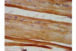 IHC image of CSB-PA007909LA01HU diluted at 1:600 and staining in paraffin-embedded human skeletal muscle tissue performed on a Leica BondTM system. After dewaxing and hydration, antigen retrieval was mediated by high pressure in a citrate buffer (pH 6.0).