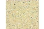 Immunohistochemistry of paraffin-embedded human liver tissue using CSB-PA007916LA01HU at dilution 1:100