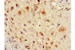 Immunohistochemistry of paraffin-embedded human placental tissue using CSB-PA007932LA01HU at dilution of 1:100