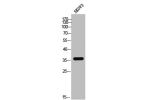 Western Blot analysis of SKOV3 cells using Ephrin-B3 Polyclonal Antibody