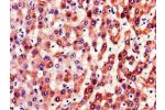 Immunohistochemistry of paraffin-embedded human liver tissue using CSB-PA007936LA01HU at dilution of 1:100
