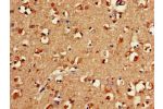 Immunohistochemistry of paraffin-embedded human brain tissue using CSB-PA007938LA01HU at dilution of 1:100