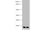 All lanes:Fatty acid-binding protein, liver antibody at 2ug/ml<br />
Lane 1: recombinant Fatty acid-binding protein, liver protein 10ng<br />
Lane 2: recombinant Fatty acid-binding protein, liver protein 100ng
Secondary<br />
Goat polyclonal to Rabbit IgG