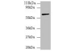 Western blot<br />
All lanes: Annexin A6 antibody at 2ug/ml+Rat liver tissue<br />
Secondary<br />
Goat polyclonal to Rabbit IgG at 1/10000 dilution<br />
Predicted band size: 76,73 kDa<br />
Observed band size: 76 kDa<br />
