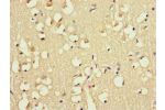 Immunohistochemistry of paraffin-embedded human brain tissue using CSB-PA007956LA01HU at dilution of 1:100
