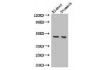 Western Blot<br />
Positive WB detected in:Mouse kidney tissue,Mouse stomach tissue<br />
All lanes: FAH antibody at 3.4ug/ml<br />
Secondary<br />
Goat polyclonal to rabbit IgG at 1/50000 dilution<br />
Predicted band size: 47,39 kDa<br />
Observed band 