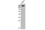 Western Blot analysis of Jurkat cells using EGFR Polyclonal Antibody
