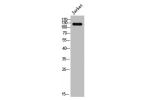 Western Blot analysis of Jurkat cells using A Cyclase IV Polyclonal Antibody