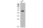 Western Blot analysis of HeLa cells using Elk-1 Polyclonal Antibody