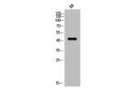 Western Blot analysis of KB cells using Elk-1 Polyclonal Antibody