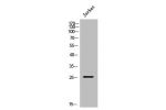 Western Blot analysis of Jurkat cells using APOBEC3A Polyclonal Antibody