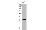 Western Blot analysis of HuvEC cells using Emx1 Polyclonal Antibody