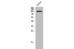 Western Blot analysis of JK cells using EphA3 Polyclonal Antibody
