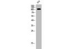 Western Blot analysis of 3T3 cells using EphB1/2/3/4 Polyclonal Antibody