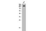 Western Blot analysis of 293 cells using EphB2 Polyclonal Antibody