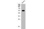 Western Blot analysis of JK cells using EpoR Polyclonal Antibody
