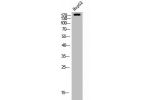 Western Blot analysis of HEPG2 cells using Neu Polyclonal Antibody
