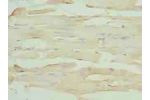 Immunohistochemistry of paraffin-embedded human skeletal muscle tissue using CSB-PA008125LA01HU at dilution of 1:100