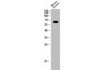 Western Blot analysis of MOUSE-BRAIN cells using ERa Polyclonal Antibody