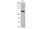 Western Blot analysis of 293 cells using ERa Polyclonal Antibody