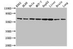 Western Blot<br />
Positive WB detected in:K562 whole cell lysate,HL-60 whole cell lysate,Hela whole cell lysate,MCF-7 whole cell lysate,HepG2 whole cell lysate,Rat liver tissue,Mouse brain tissue,Mouse lung tissue<br />
All lanes:EIF3D antibody at 2