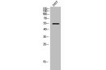 Western Blot analysis of 293T cells using ETS1 Polyclonal Antibody