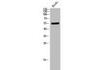 Western Blot analysis of HuvEc cells using TEL Polyclonal Antibody