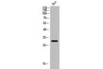 Western Blot analysis of rat cells using Cleaved-Factor Xa activated HC (I235) Polyclonal Antibody