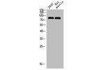 Western Blot analysis of RAT-MUSCLE 293T cells using Seprase Polyclonal Antibody