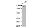 Western Blot<br />
Positive WB detected in:Mouse kidney tissue<br />
All lanes:ACTN4 antibody at 3.4