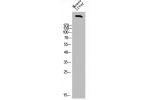 Western Blot analysis of mouse-liver cells using FBN1 Polyclonal Antibody