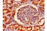 Immunohistochemistry of paraffin-embedded human kidney tissue using CSB-PA008226LA01HU at dilution of 1:100