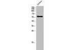 Western Blot analysis of Jurkat cells using CGI-43 Polyclonal Antibody