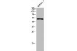 Western Blot analysis of RAW264.7 cells using c-Fgr Polyclonal Antibody