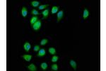 Immunofluorescence staining of A549 cells with CSB-PA008279LA01HU at 1:200,counter-stained with DAPI. The cells were fixed in 4% formaldehyde, permeabilized using 0.2% Triton X-100 and blocked in 10% normal Goat Serum. The cells were then incubated with t