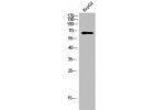 Western Blot analysis of HepG2 cells using TCP-1 e Polyclonal Antibody