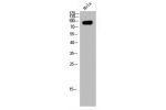 Western Blot analysis of HeLa cells using ABCF1 Polyclonal Antibody