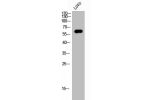 Western Blot analysis of LOVO cells using FoxJ1 Polyclonal Antibody