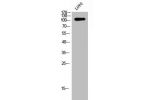 Western Blot analysis of LOVO cells using Glucosidase IIa Polyclonal Antibody