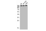 Western blot analysis of KB SH-SY5Y 293T lysis using Flt-1 antibody.