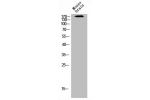 Western Blot analysis of mouse-brain cells using Flt-1 Polyclonal Antibody