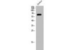Western Blot analysis of Jurkat cells using CstF-64T Polyclonal Antibody