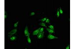 Immunofluorescent analysis of Hela cells using CSB-PA008413LA01HU at a dilution of 1:100 and Alexa Fluor 488-congugated AffiniPure Goat Anti-Rabbit IgG(H+L)