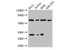 Western Blot<br />
Positive WB detected in:HepG2 whole cell lysate,Jurkat whole cell lysate,K562 whole cell lysate,NIH/3T3 whole cell lysate<br />
All lanes:FANCC antibody at 3
