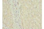 Immunohistochemistry of paraffin-embedded human liver tissue using CSB-PA008436ESR1HU at dilution 1:100
