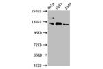 Western Blot<br />
Positive WB detected in:Hela whole cell lysate,U251 whole cell lysate,A549 whole cell lysate<br />
All lanes:FBLN2 antibody at 3.4