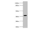Western blot<br />
All lanes:FBP1 antibody at 3.06ug/ml<br />
Lane 1:mouse liver tissue<br />
Lane 2:mouse kidney tissue<br />
Secondary<br />
Goat polyclonal to rabbit at 1/10000 dilution<br />
Predicted band size: 37kDa<br />
Observed band size: 37kDa<b